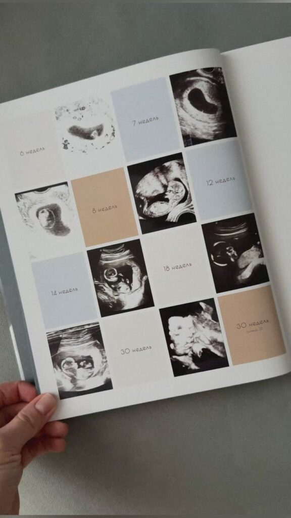 The best way to tell your parents that you are having a child