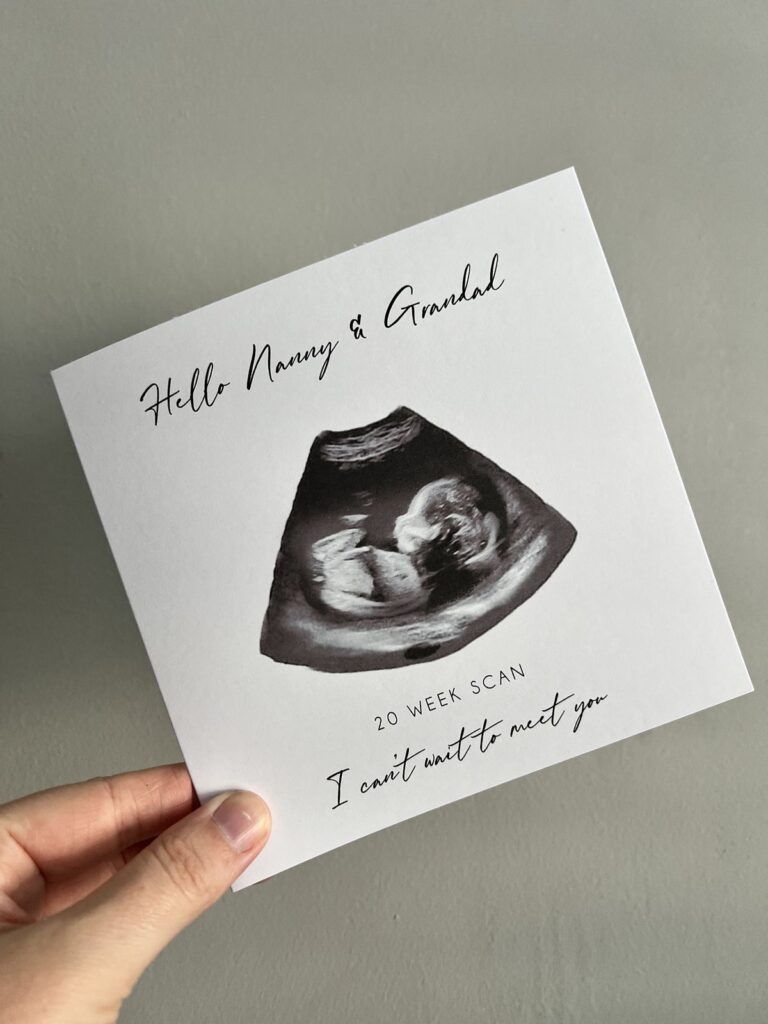 Unique Ways to Tell Grandparents You’re Expecting